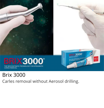 Brix 3000 Carles removal without Aerosol drilling.