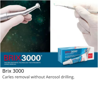 Brix 3000 Carles removal without Aerosol drilling.
